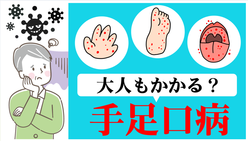 YouTube 【手足口病】高齢者でも感染の可能性。症状や対策は?