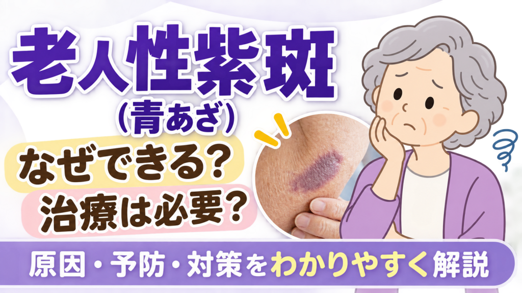 【YouTube】高齢者の皮下出血「老人性紫斑」とは？